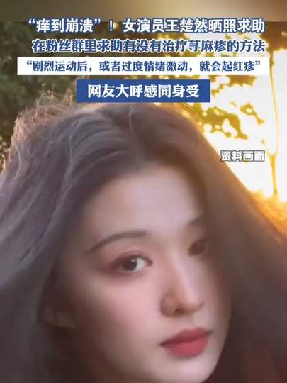 女演员王楚然晒照求荨麻疹治疗方案