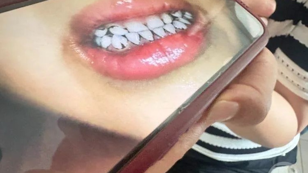 甘肃天水一幼儿园有幼儿出现血铅异常，有患儿血铅含量是家长的12倍