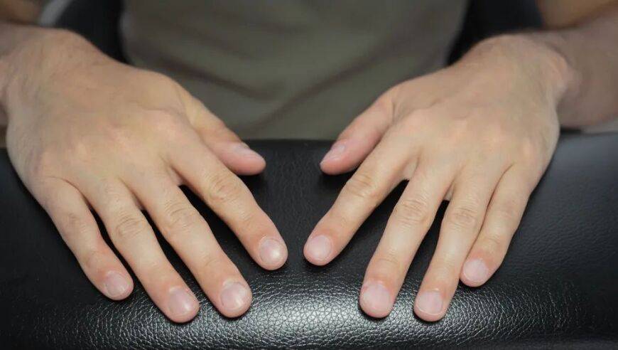 指甲长白斑，表示身体有疾病？